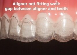 Invisalign not fitting properly